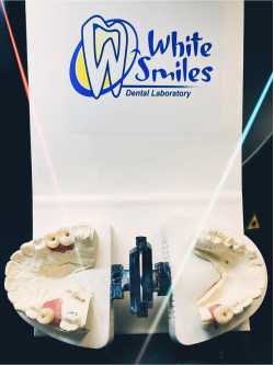 White Smiles Dental Lab