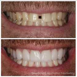 Hammond Aesthetic & General Dentistry