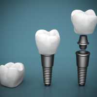 Kiwan Dental  Care & Dental Implants  Center Logo