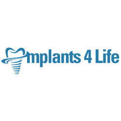 Implants4Life